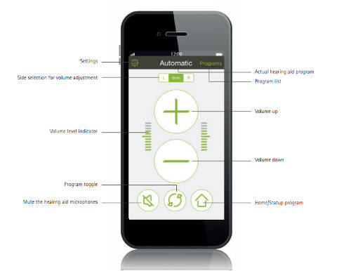 The Phonak RC App explainer